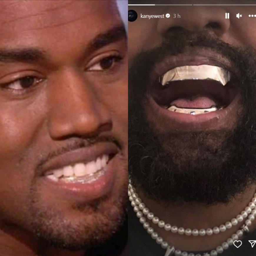 Remove os dentes e os substitui por próteses de TITÂNIO ‘mais caras que diamantes’
